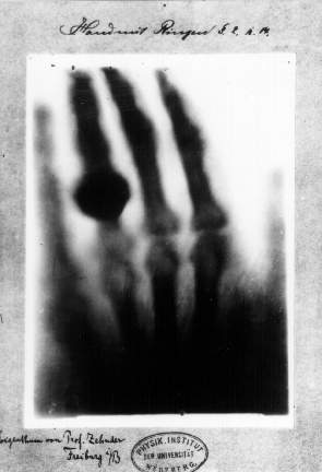 The world's first medical X-ray